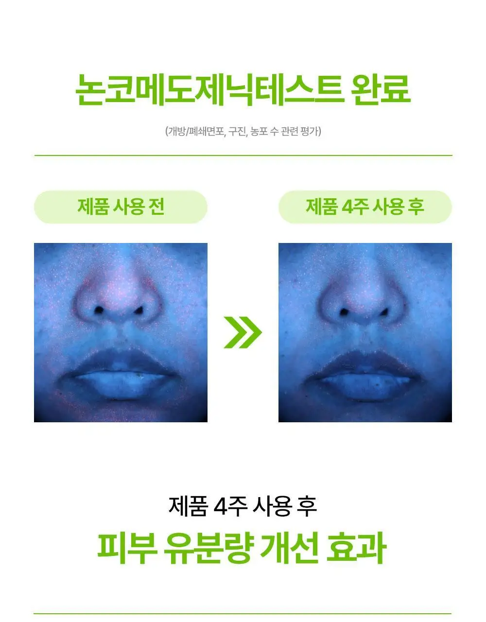 [여드름/쿨링] 리얼베리어 컨트롤-T 티트리 AC 쿨링 클렌징젤 200ml 기획 (+30ml) 상세페이지 33